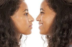 Rhinoplasty Colne