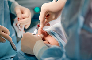 Rhinoplasty Surgeon Colne Lancashire or Near Me