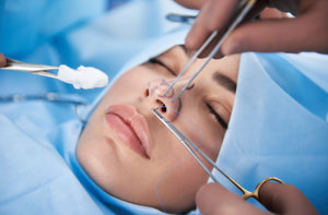 Rhinoplasty Surgery Birmingham (0121)